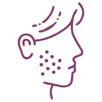 Tratamento para Acne